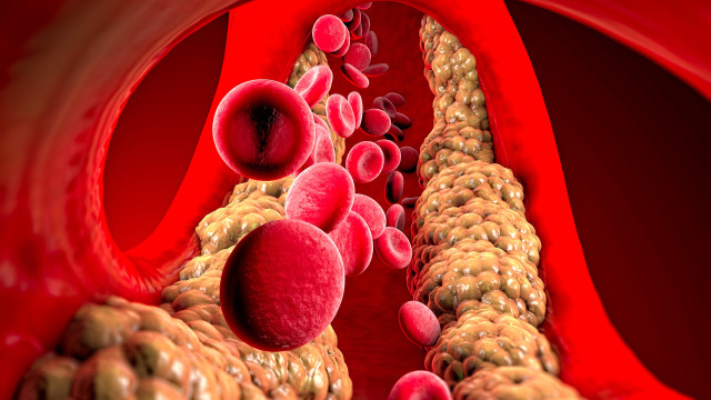 Colesterol alto pode causar disfunção sexual em homens e mulheres