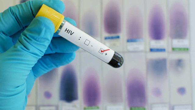 Estados Unidos iniciam testes de nova vacina experimental contra HIV em humanos