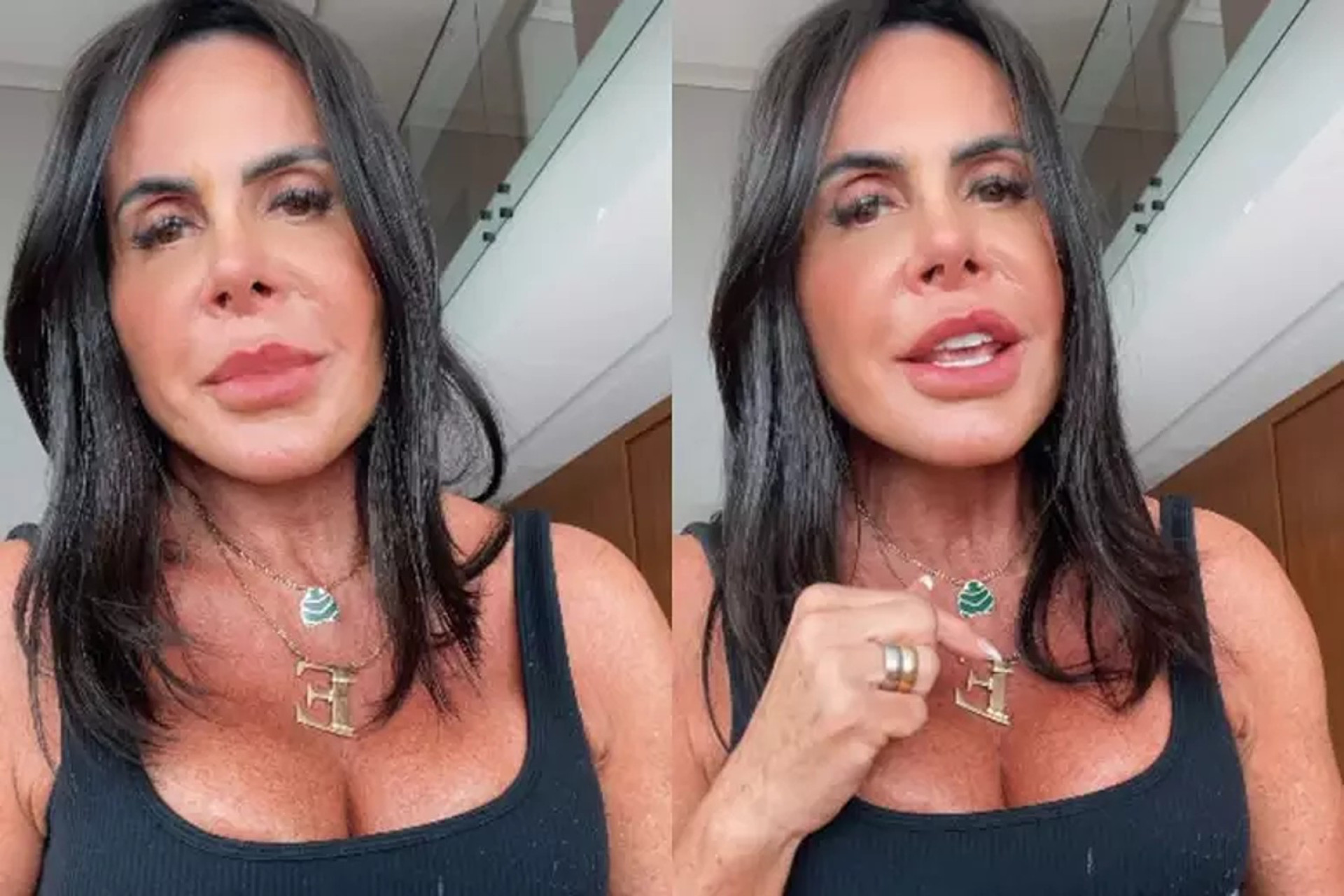 Gretchen celebra novo procedimento estético; veja o resultado