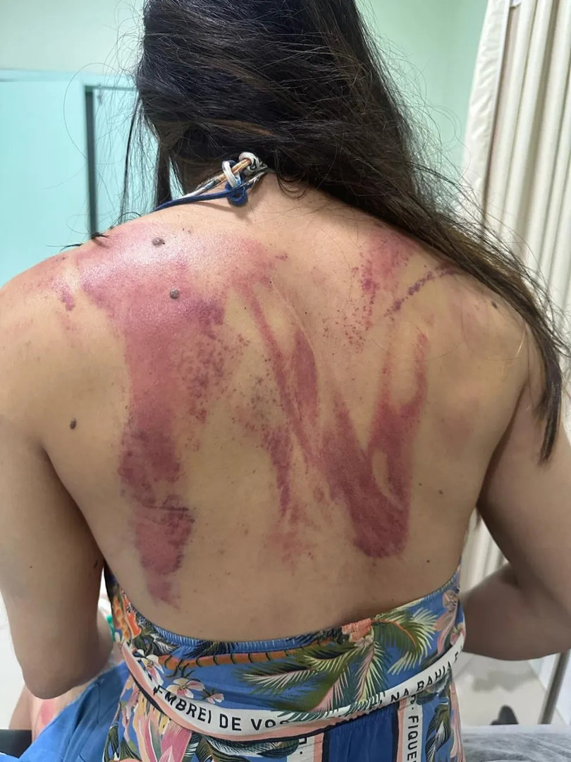 Pai tenta matar filha a golpes de terçado em Bragança; imagens fortes