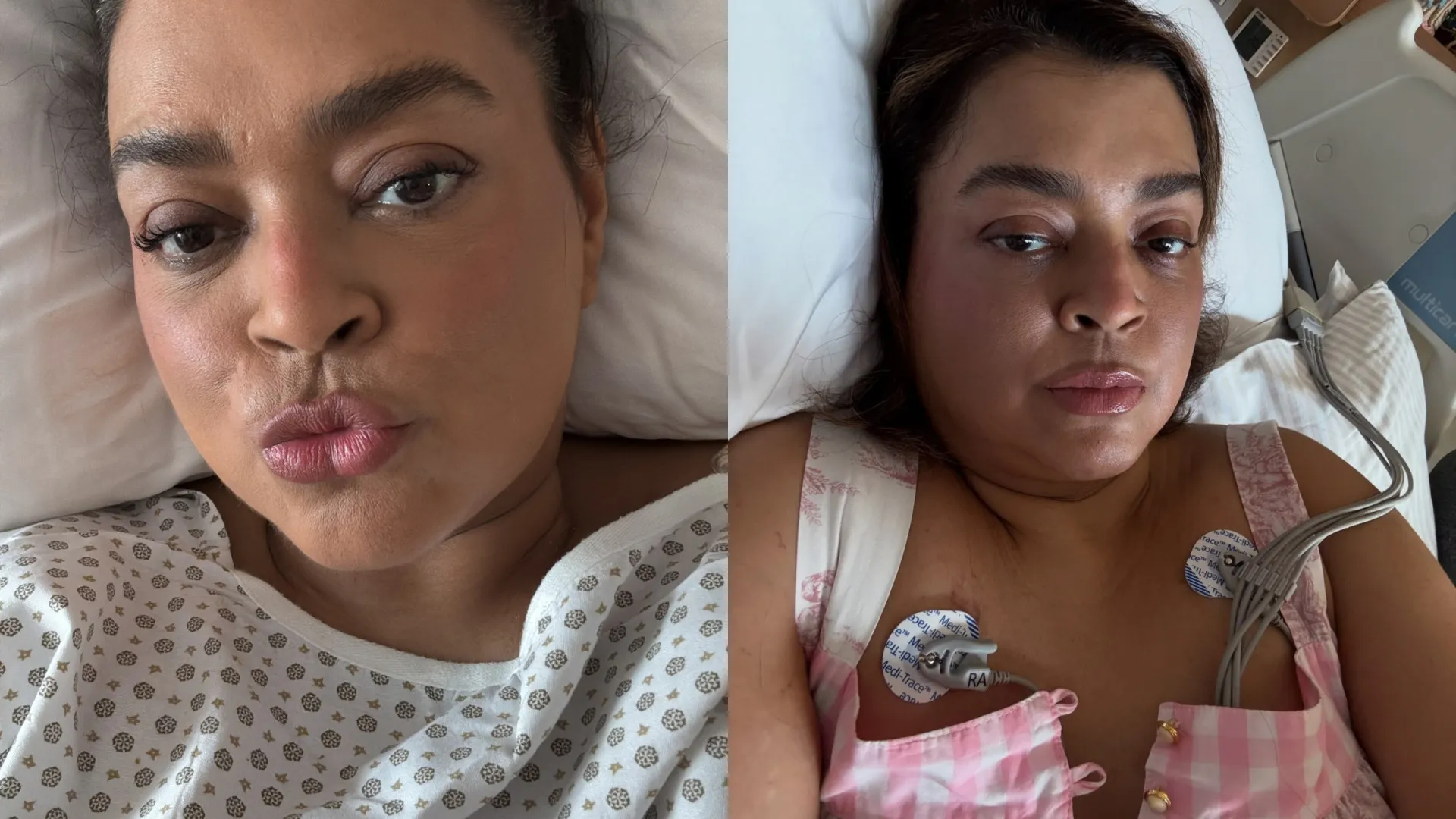 Preta Gil inicia tratamento experimental contra câncer nos EUA