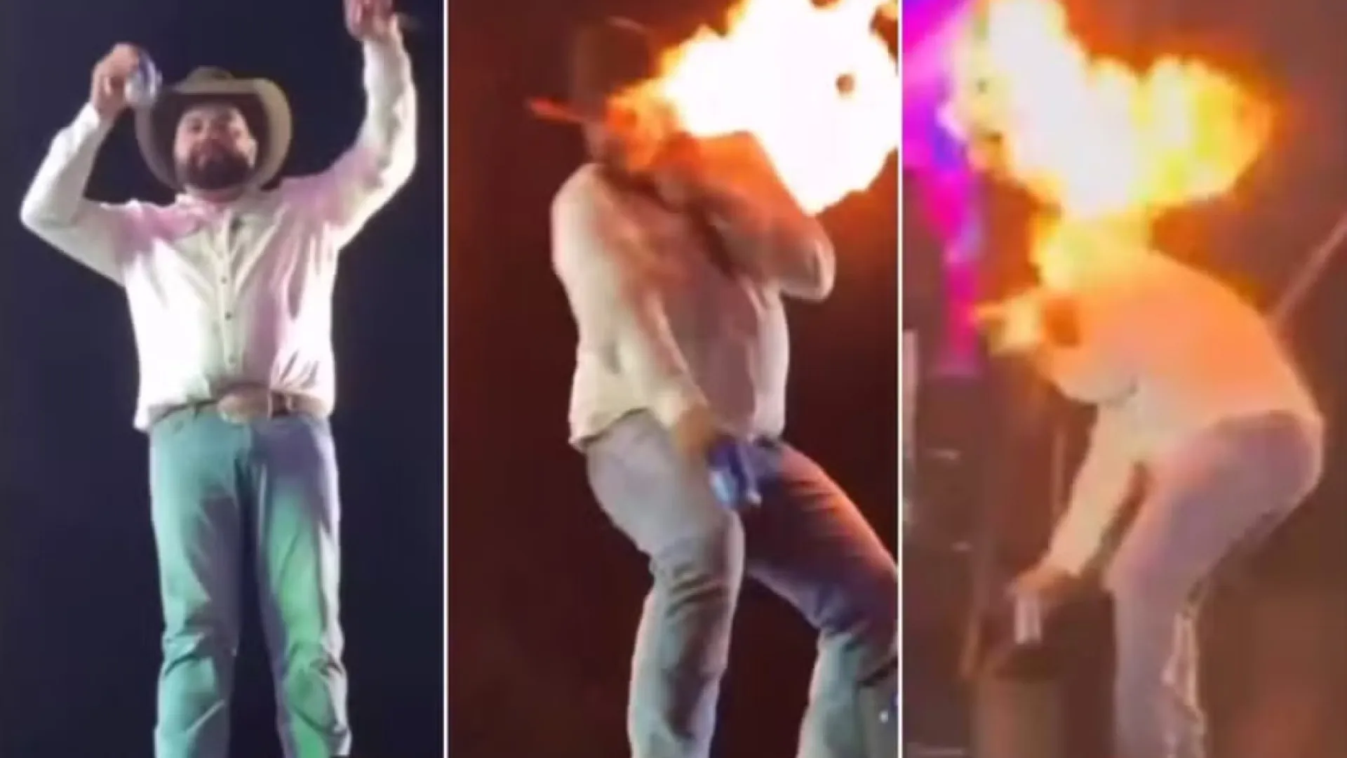 Sertanejo mostra como ficou seu rosto após ser queimado em show; vídeo