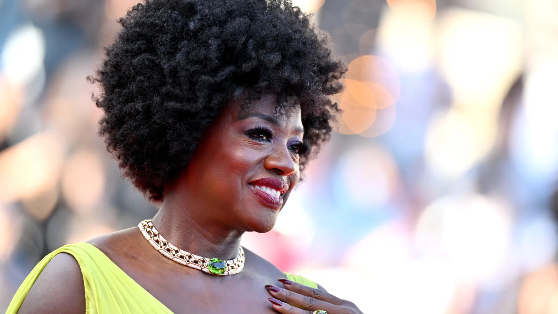 Alopecia: Quando até famosos ficam carecas