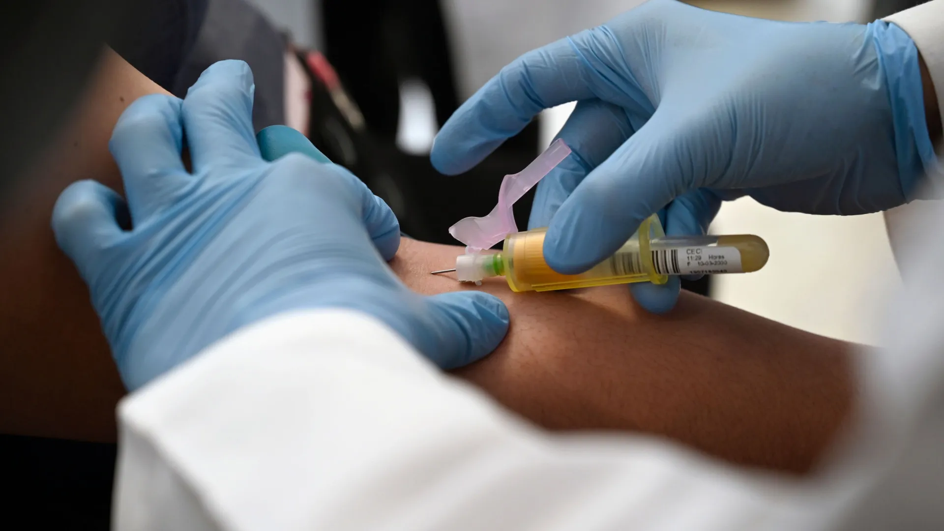 Novo paciente tem remissão do HIV, aponta revista Nature