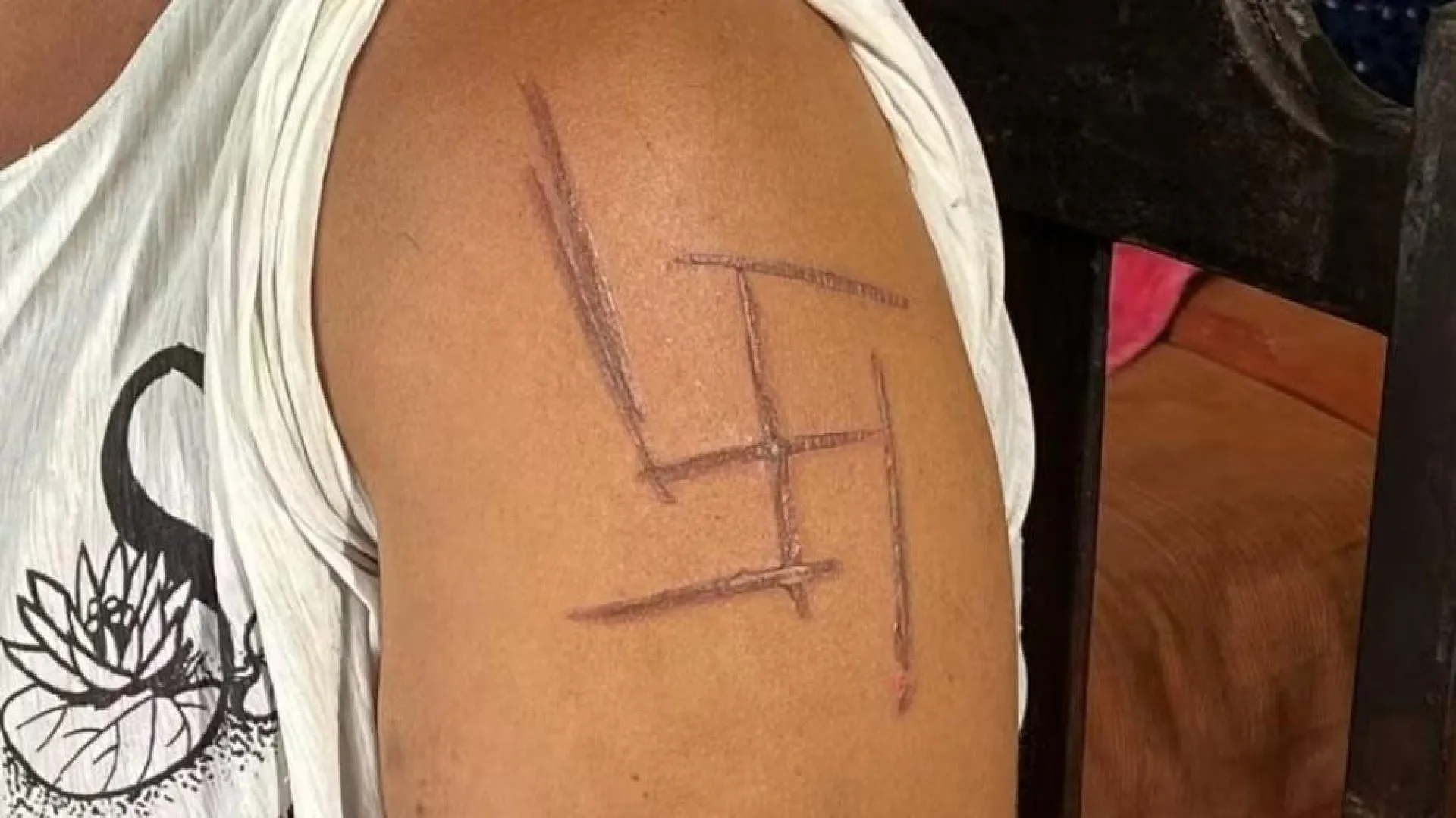 Mulher é marcada por suástica nazista após ser espancada por patrões