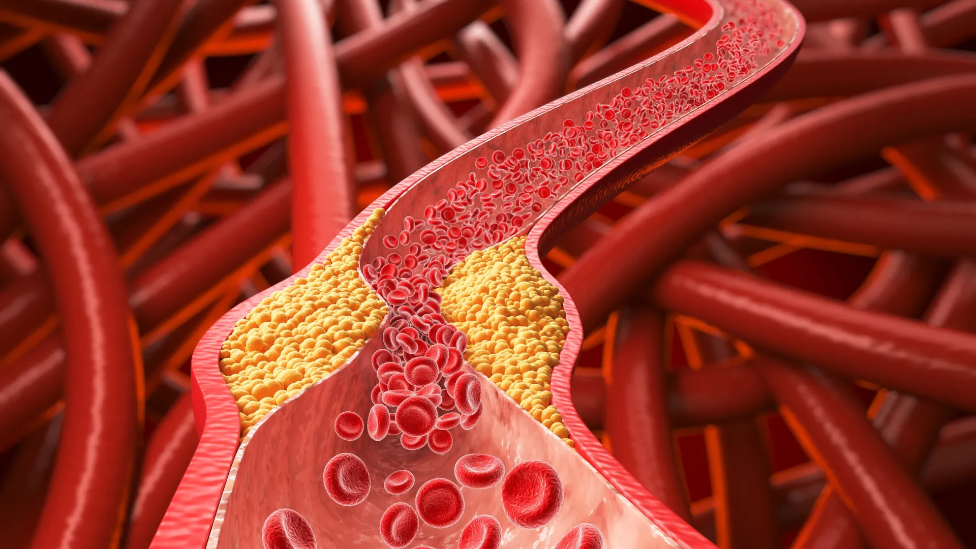 Alimento comum pode ajudar a derrubar o colesterol “ruim”