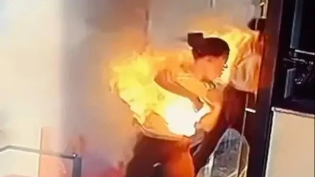 Influenciadora sofre queimaduras graves após carregador explodir; vídeo
